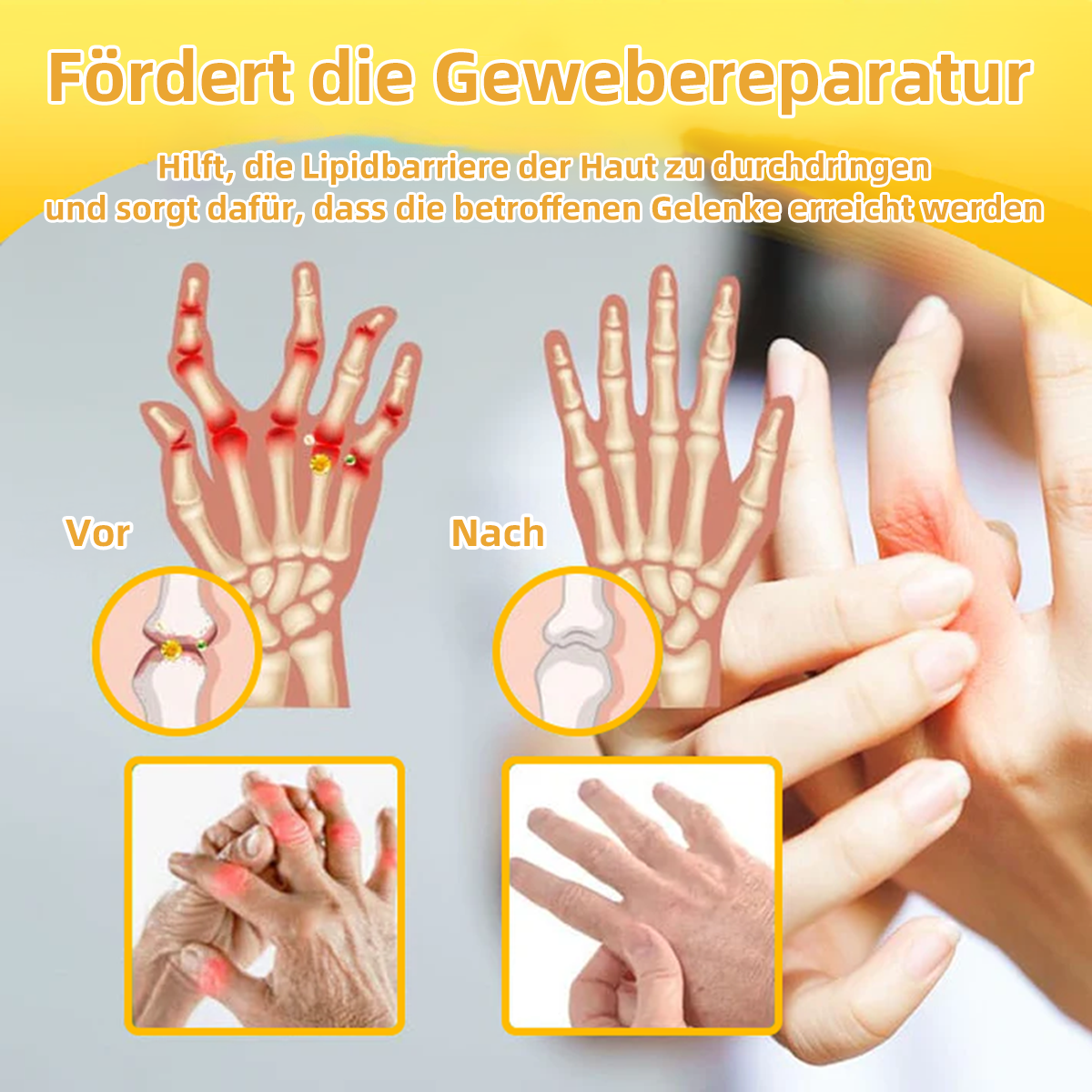 TLOPA® Schmerzlindernde Knochenheilungscreme mit Botulinumtoxin und Bienengift 👨⚕️👨⚕️Zugelassen von der Deutschen Gesellschaft für Orthopädische Chirurgie (DGOOC)