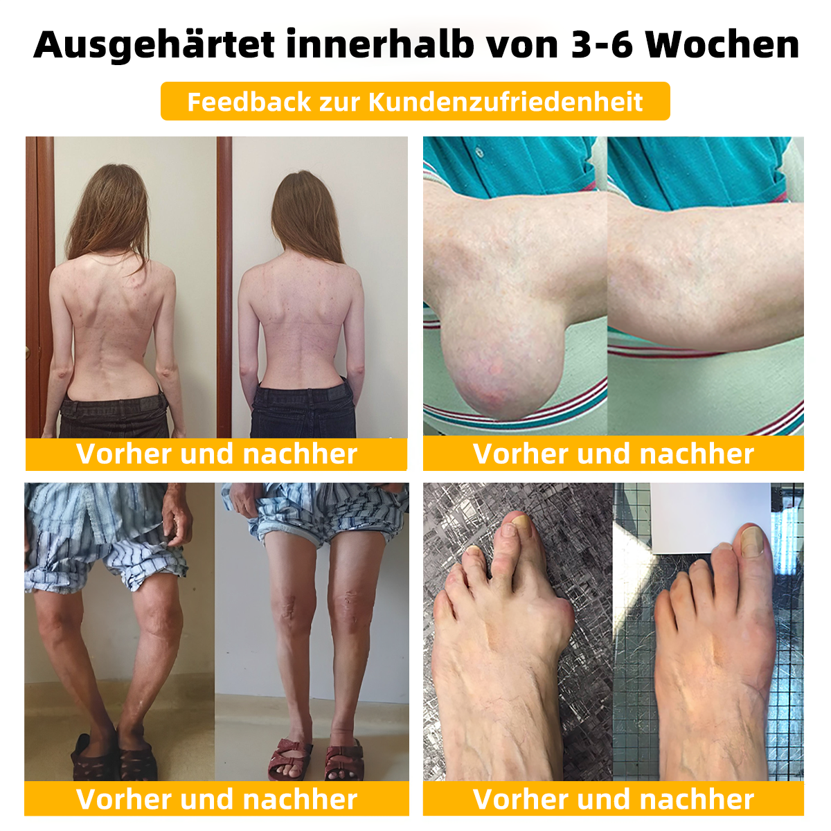TLOPA® Schmerzlindernde Knochenheilungscreme mit Botulinumtoxin und Bienengift 👨⚕️👨⚕️Zugelassen von der Deutschen Gesellschaft für Orthopädische Chirurgie (DGOOC)