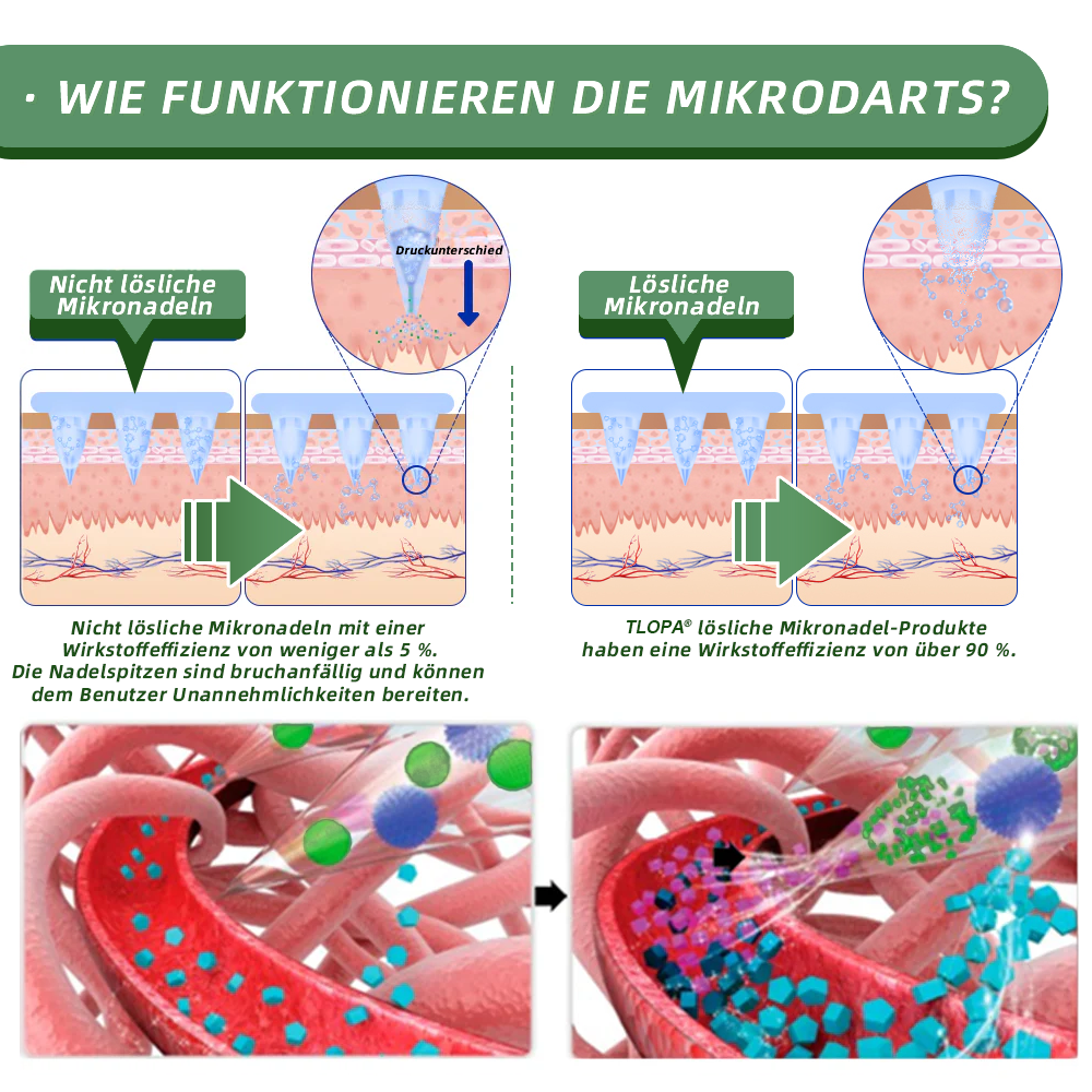 TLOPA®SMGT-GLP-1 Nano-Mikronadel-Pflaster🥑(Schmerzfrei, lang anhaltend, gegen Diabetes, Fettleibigkeit und Herz-Kreislauf-Erkrankungen)