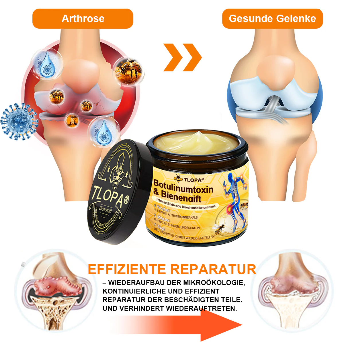 TLOPA® Schmerzlindernde Knochenheilungscreme mit Botulinumtoxin und Bienengift 👨⚕️👨⚕️Zugelassen von der Deutschen Gesellschaft für Orthopädische Chirurgie (DGOOC)