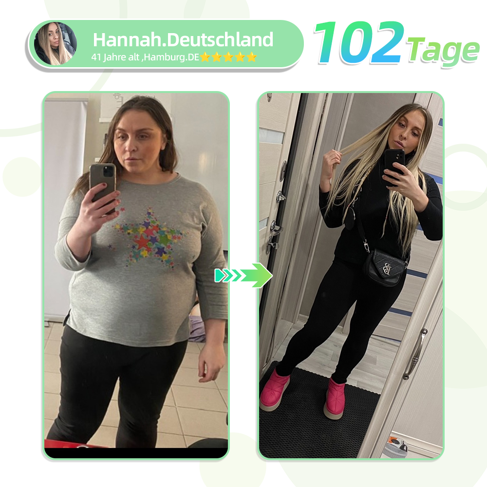 TLOPA®SMGT-GLP-1 Nano-Mikronadel-Pflaster🥑(Schmerzfrei, lang anhaltend, gegen Diabetes, Fettleibigkeit und Herz-Kreislauf-Erkrankungen)