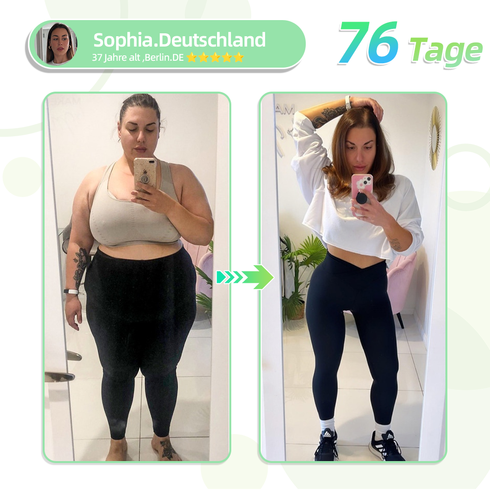 TLOPA®SMGT-GLP-1 Nano-Mikronadel-Pflaster🥑(Schmerzfrei, lang anhaltend, gegen Diabetes, Fettleibigkeit und Herz-Kreislauf-Erkrankungen)