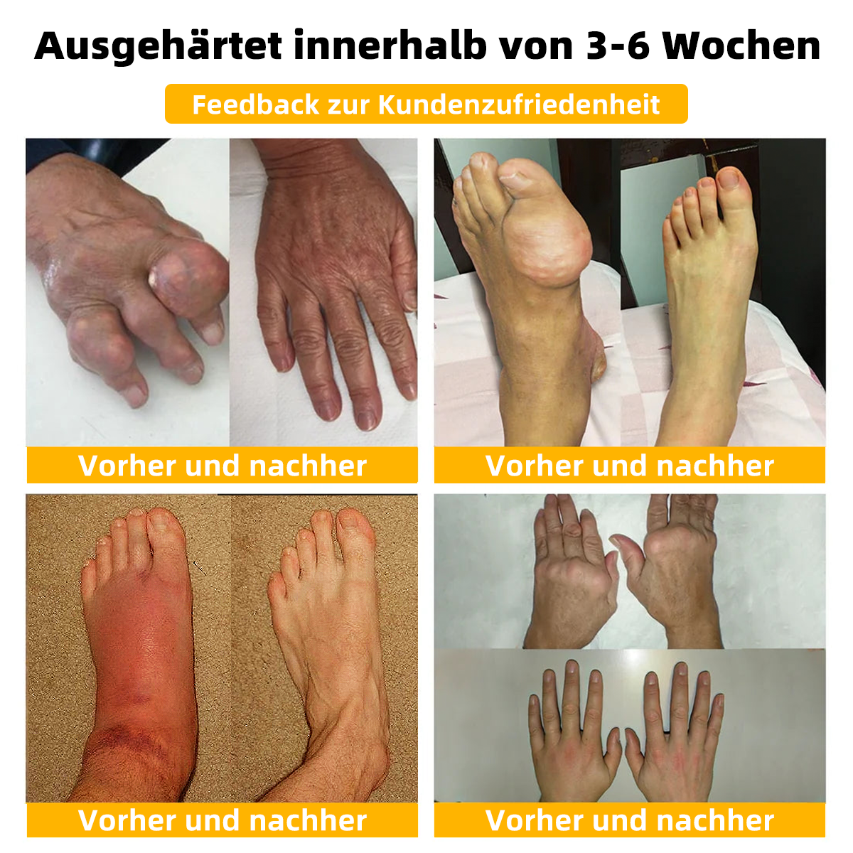 TLOPA® Schmerzlindernde Knochenheilungscreme mit Botulinumtoxin und Bienengift 👨⚕️👨⚕️Zugelassen von der Deutschen Gesellschaft für Orthopädische Chirurgie (DGOOC)