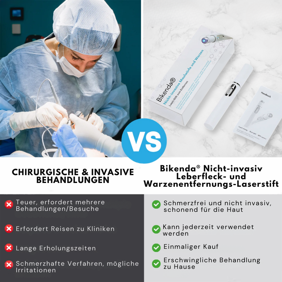 Bikenda® Nicht-invasiv Leberfleck- und Warzenentfernungs-Laserstift