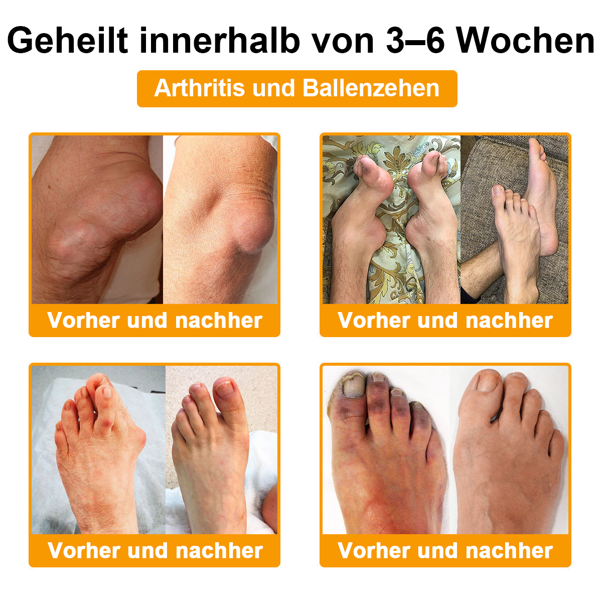 TLOPA® Schmerzlindernde Knochenheilungscreme mit Botulinumtoxin und Bienengift 👨⚕️👨⚕️Zugelassen von der Deutschen Gesellschaft für Orthopädische Chirurgie (DGOOC)