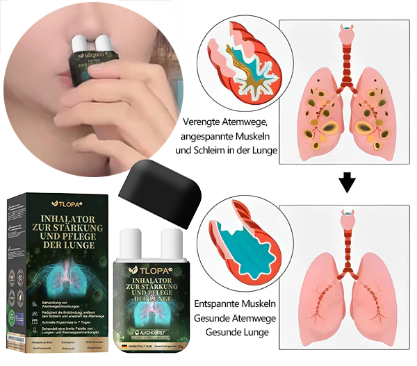 TLOPA® 𝐋𝐮𝐧𝐠𝐞𝐧𝐬𝐭ä𝐫𝐤𝐞𝐧𝐝𝐞 𝐮𝐧𝐝 -𝐩𝐟𝐥𝐞𝐠𝐞𝐧𝐝𝐞 𝐈𝐧𝐡𝐚𝐥𝐚𝐭𝐢𝐨𝐧𝐬𝐠𝐞𝐫ä𝐭𝐞(𝐄𝐦𝐩𝐟𝐨𝐡𝐥𝐞𝐧 𝐯𝐨𝐧 𝐋𝐮𝐧𝐠𝐞𝐧𝐬𝐩𝐞𝐳𝐢𝐚𝐥𝐢𝐬𝐭𝐞𝐧🍀)