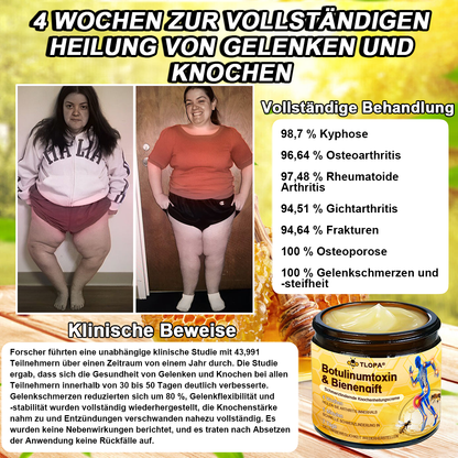 TLOPA® Schmerzlindernde Knochenheilungscreme mit Botulinumtoxin und Bienengift 👨‍⚕️👨‍⚕️Zugelassen von der Deutschen Gesellschaft für Orthopädische Chirurgie (DGOOC)