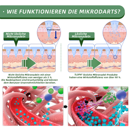 TLOPA®SMGT-GLP-1 Nano-Mikronadel-Pflaster🥑（Schmerzfrei, lang anhaltend, gegen Diabetes, Fettleibigkeit und Herz-Kreislauf-Erkrankungen）