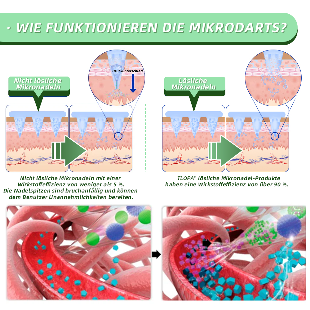 TLOPA®SMGT-GLP-1 Nano-Mikronadel-Pflaster（👨‍⚕️Schmerzfrei, lang anhaltend, gegen Diabetes, Fettleibigkeit und Herz-Kreislauf-Erkrankungen）